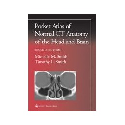 Pocket Atlas of Normal CT Anatomy of the Head and Brain