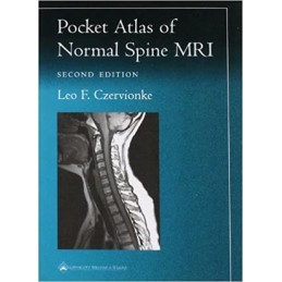 Pocket Atlas of Spinal MRI