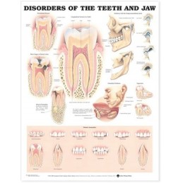 Disorders of the Teeth and...