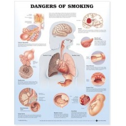 Dangers of Smoking Anatomical Chart