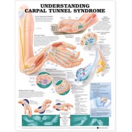 Understanding Carpal Tunnel...