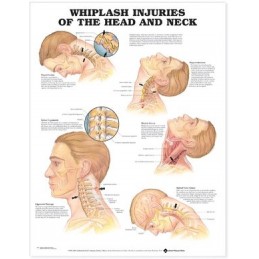 Whiplash Injuries of the...