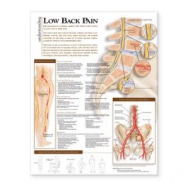 Understanding Low Back Pain...