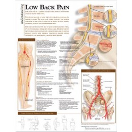 Understanding Low Back Pain Anatomical Chart