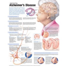 Understanding Alzheimer's...