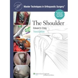 Master Techniques in Orthopaedic Surgery: Shoulder