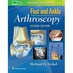 Foot & Ankle Arthroscopy