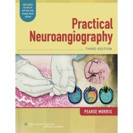 Practical Neuroangiography