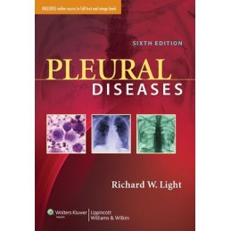 Pleural Diseases