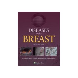 Diseases of the Breast 5e