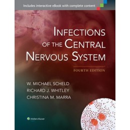 Infections of the Central...