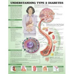 Understanding Type 2...