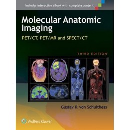 Molecular Anatomic Imaging: PET/CT, PET/MR and SPECT CT