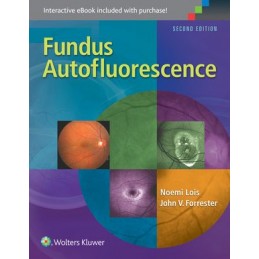 Fundus Autofluorescence