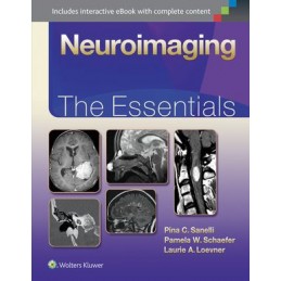 Neuroimaging: The Essentials