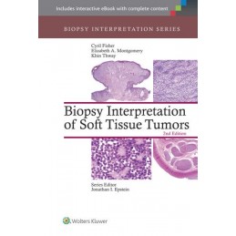 Biopsy Interpretation of...