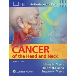 Cancer of the Head and Neck