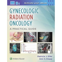 Gynecologic Radiation...