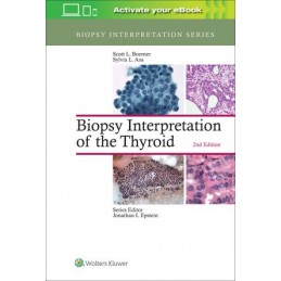 Biopsy Interpretation of...