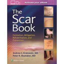 The Scar Book: Formation,...