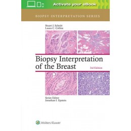 Biopsy Interpretation of...