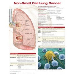 Non-Small Cell Lung Cancer