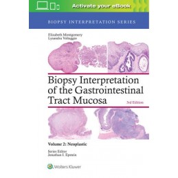 Biopsy Interpretation of...