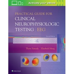 Practical Guide for Clinical Neurophysiologic Testing: EEG