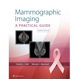 Mammographic Imaging