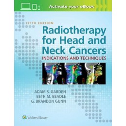 Radiotherapy for Head and Neck Cancers: Indications and Techniques