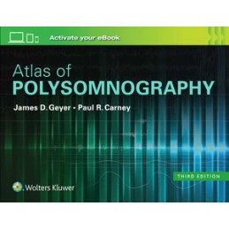 Atlas of Polysomnography