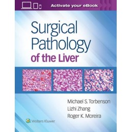 Surgical Pathology of the Liver