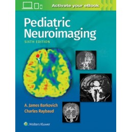 Pediatric Neuroimaging