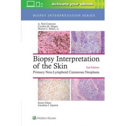 Biopsy Interpretation of...