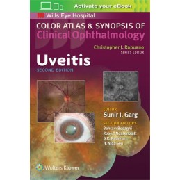 Uveitis