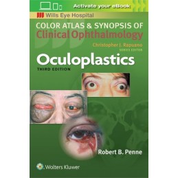 Oculoplastics