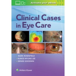 Clinical Cases in Eye Care