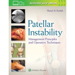 Patellar Instability:...