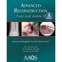 Advanced Reconstruction:...