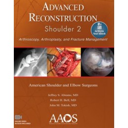 Advanced Reconstruction:...