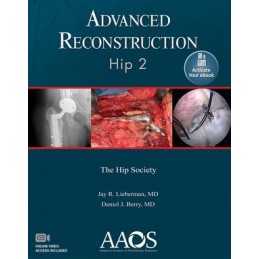 Advanced Reconstruction:...