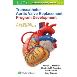 Transcatheter Aortic Valve...