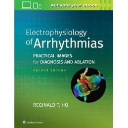 Electrophysiology of...