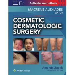 Cosmetic Dermatologic Surgery