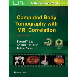 Computed Body Tomography...