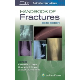 Handbook of Fractures