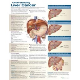 Understanding Liver Cancer...