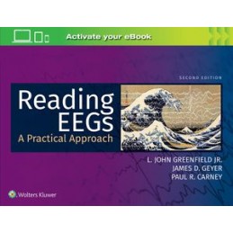 Reading EEGs: A Practical Approach