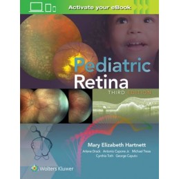 Pediatric Retina