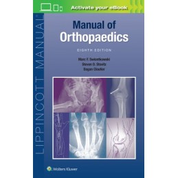 Manual of Orthopaedics